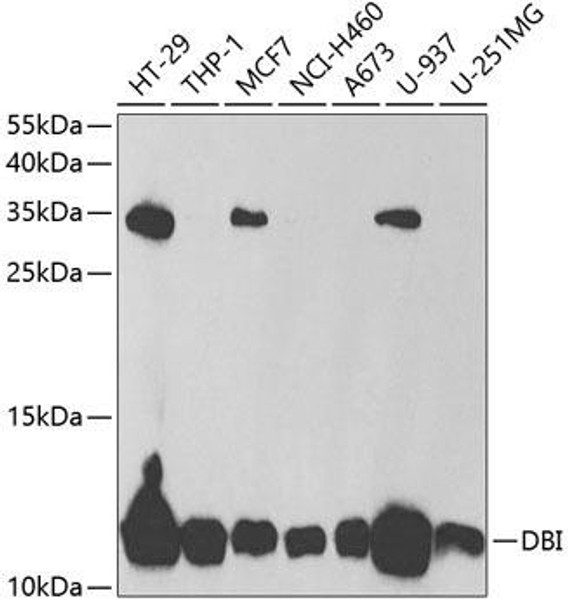 Signal Transduction Antibodies 3 Anti-DBI Antibody CAB5370