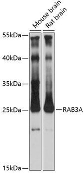 Cell Biology Antibodies 9 Anti-RAB3A Antibody CAB5379