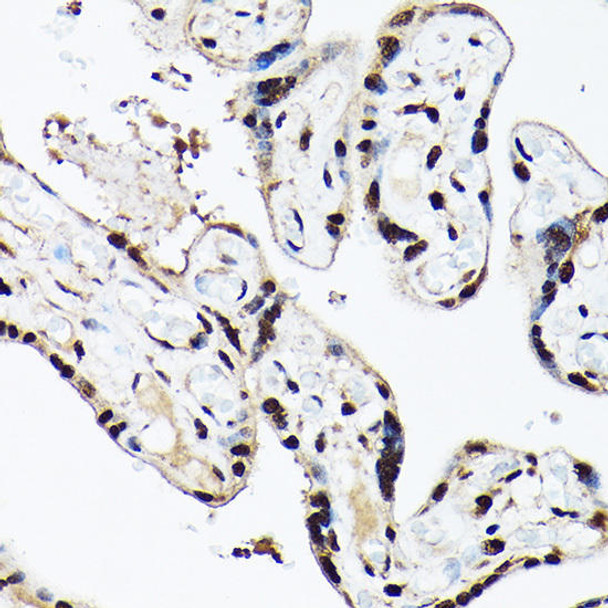 Epigenetics and Nuclear Signaling Antibodies 3 Anti-ACTL6A Antibody CAB5387