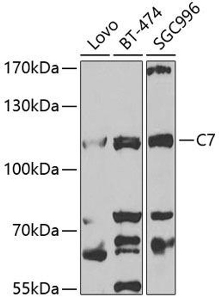 Immunology Antibodies 2 Anti-C7 Antibody CAB5394