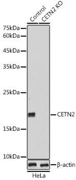 KO Validated Antibodies 1 Anti-CETN2 Antibody CAB5397KO Validated