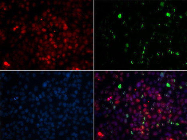 KO Validated Antibodies 1 Anti-CETN2 Antibody CAB5397KO Validated