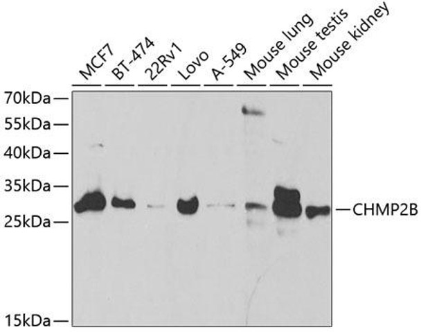 Cell Biology Antibodies 9 Anti-CHMP2B Antibody CAB5399