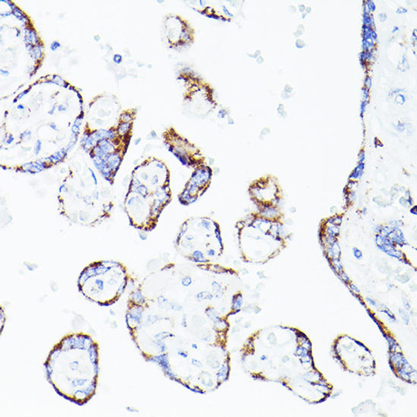 Cell Biology Antibodies 9 Anti-DLD Antibody CAB5403