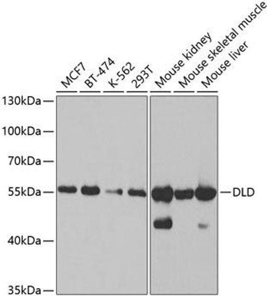 Cell Biology Antibodies 9 Anti-DLD Antibody CAB5403