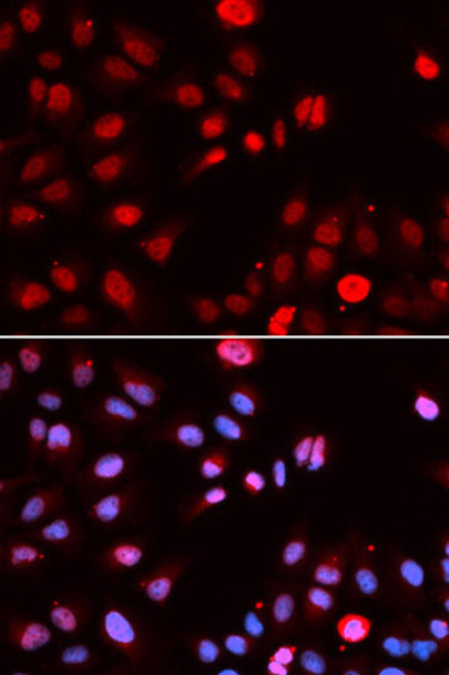 Epigenetics and Nuclear Signaling Antibodies 3 Anti-MPG Antibody CAB5410