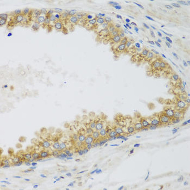 Cell Biology Antibodies 9 Anti-SIRT3 Antibody CAB5419