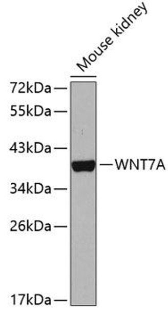 Metabolism Antibodies 2 Anti-WNT7A Antibody CAB5425