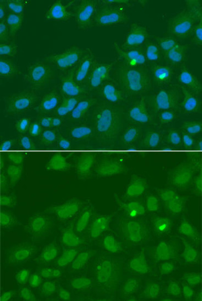 Epigenetics and Nuclear Signaling Antibodies 3 Anti-ORC6 Antibody CAB5426