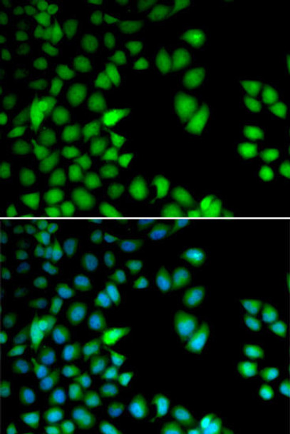 Cell Cycle Antibodies 1 Anti-RPS6KA3 Antibody CAB5436