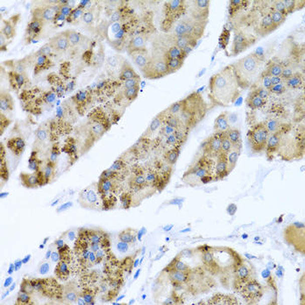 Cell Biology Antibodies 9 Anti-MGP Antibody CAB5439