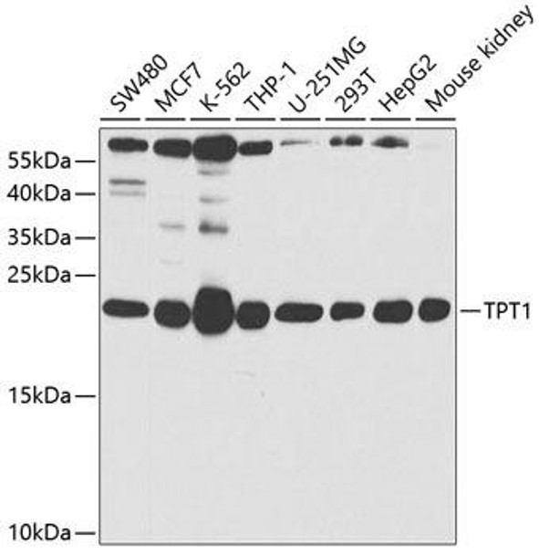 Cell Biology Antibodies 9 Anti-TPT1 Antibody CAB5442