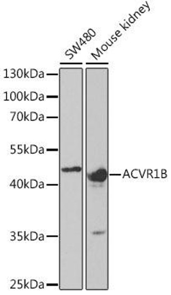 Cell Biology Antibodies 9 Anti-ACVR1B Antibody CAB5453