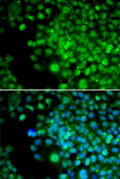 Developmental Biology Anti-FHL1 Antibody CAB5460