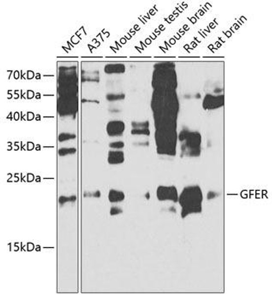 Cell Biology Antibodies 9 Anti-GFER Antibody CAB5463