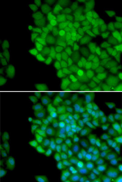 Epigenetics and Nuclear Signaling Antibodies 3 Anti-MAGEA1 Antibody CAB5470