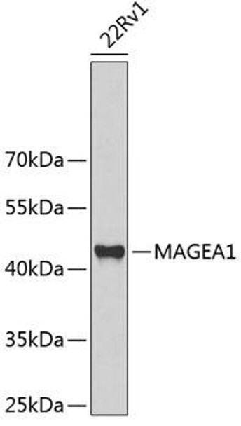 Epigenetics and Nuclear Signaling Antibodies 3 Anti-MAGEA1 Antibody CAB5470