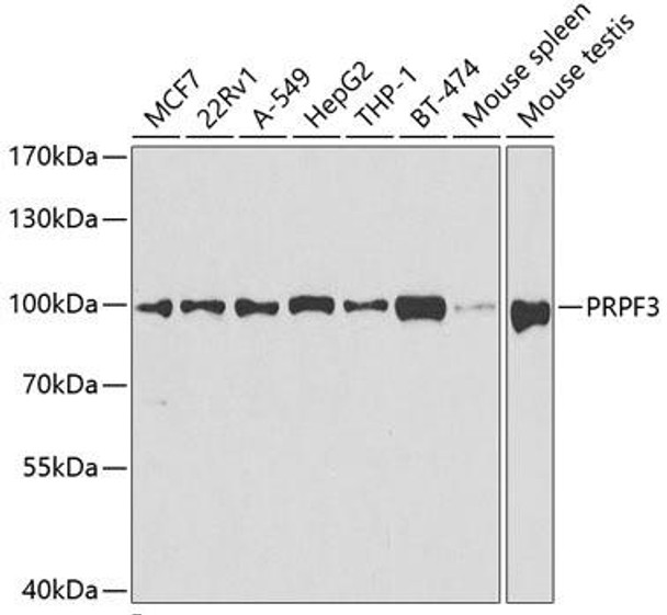 Epigenetics and Nuclear Signaling Antibodies 3 Anti-PRPF3 Antibody CAB5482