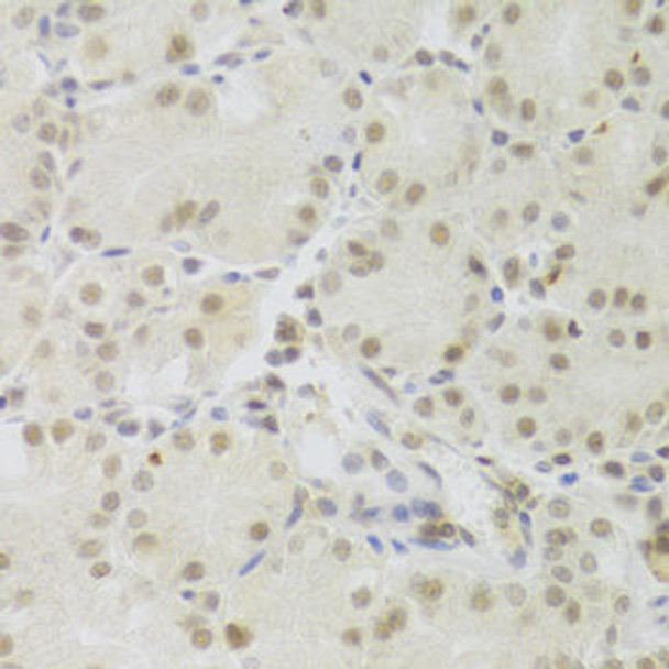 Epigenetics and Nuclear Signaling Antibodies 3 Anti-PRPF3 Antibody CAB5482