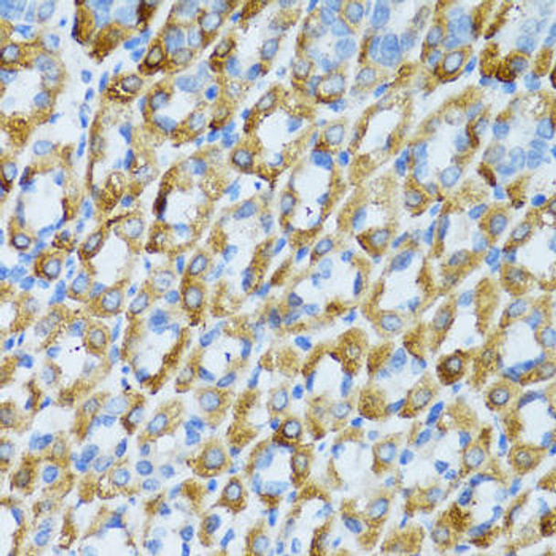 Cell Cycle Antibodies 1 Anti-PSRC1 Antibody CAB5484