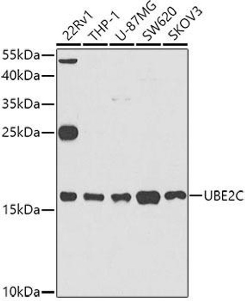 Cell Cycle Antibodies 1 Anti-UBE2C Antibody CAB5499