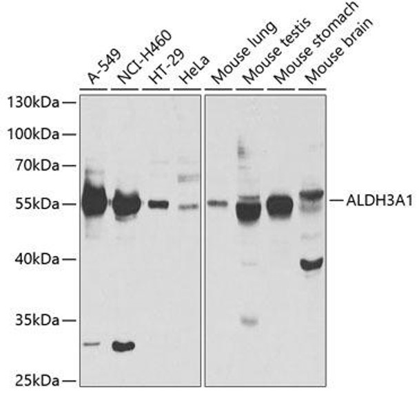 Cell Biology Antibodies 9 Anti-ALDH3A1 Antibody CAB5502