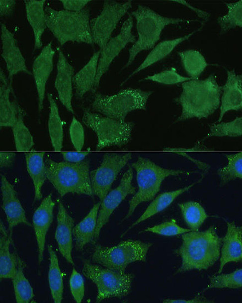 Cell Biology Antibodies 9 Anti-CGRP Antibody CAB5542