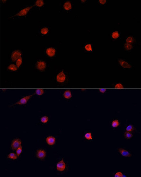 Epigenetics and Nuclear Signaling Antibodies 3 Anti-PRDM14 Antibody CAB5543