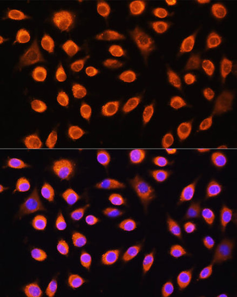 Cell Biology Antibodies 9 Anti-GNAS Antibody CAB5546