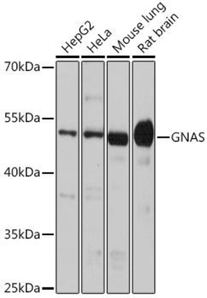 Cell Biology Antibodies 9 Anti-GNAS Antibody CAB5546