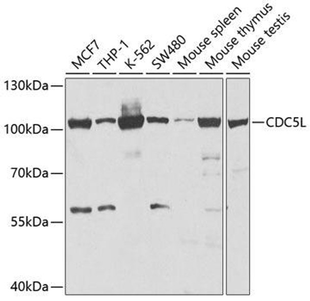 Cell Cycle Antibodies 1 Anti-CDC5L Antibody CAB5560