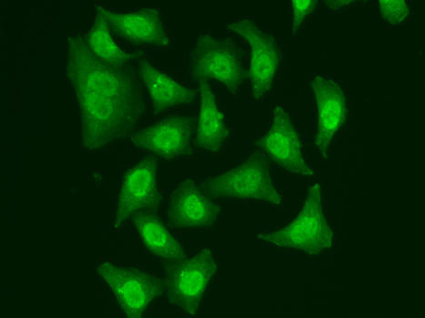 Cell Cycle Antibodies 1 Anti-CDC5L Antibody CAB5560