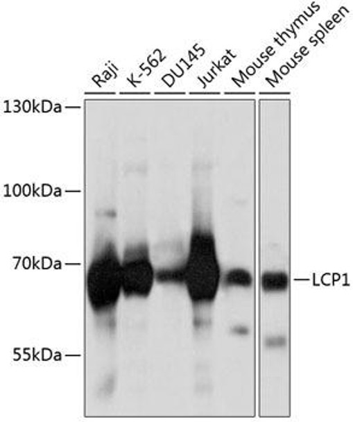 Cell Biology Antibodies 9 Anti-LCP1 Antibody CAB5561