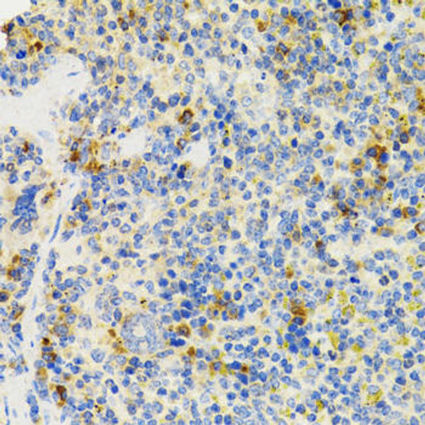 Cell Biology Antibodies 9 Anti-SH2B1 Antibody CAB5564