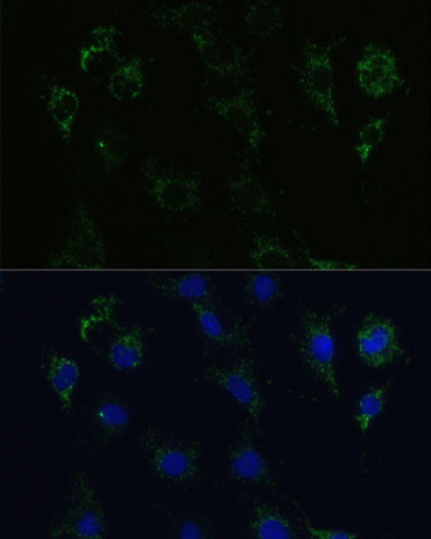 Cell Biology Antibodies 9 Anti-STX1A Antibody CAB5570