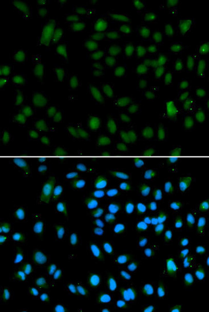 Epigenetics and Nuclear Signaling Antibodies 3 Anti-WHSC1L1 Antibody CAB5577