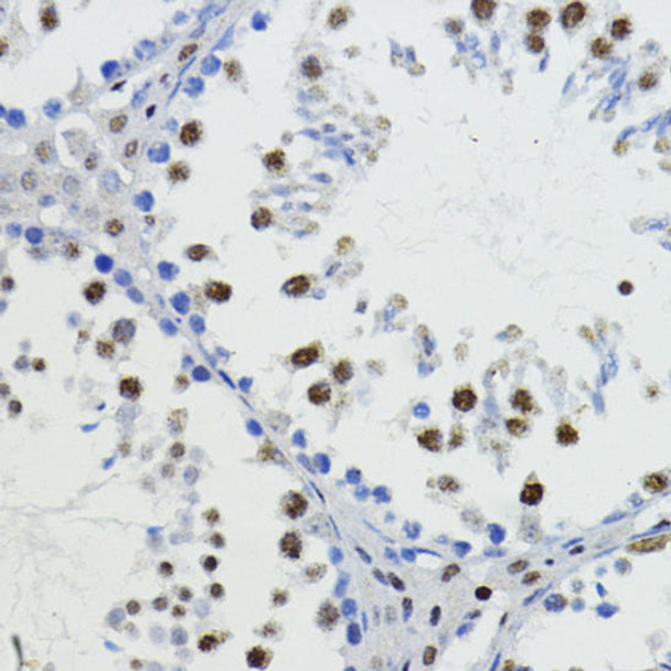 Developmental Biology Anti-ZEB1 Antibody CAB5600