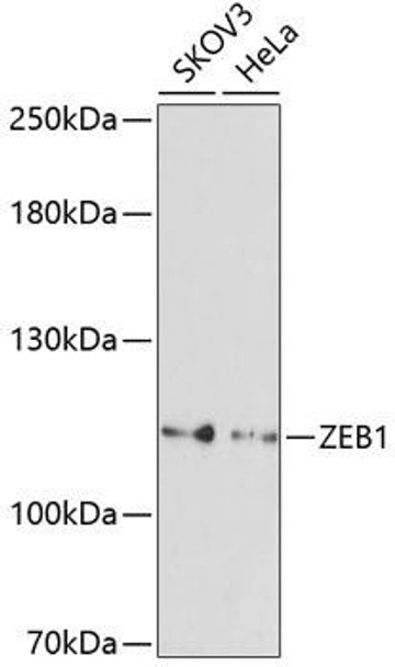 Developmental Biology Anti-ZEB1 Antibody CAB5600