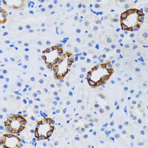 Cell Death Antibodies 2 Anti-GABARAP Antibody CAB5616