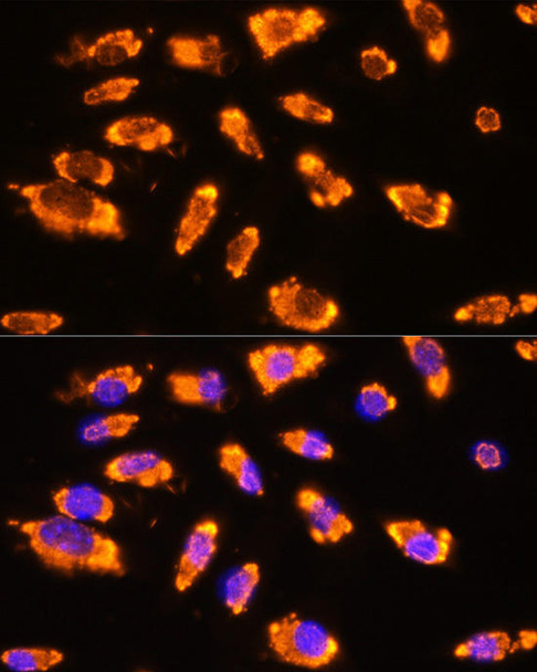 Cell Biology Antibodies 9 Anti-GNRH1 Antibody CAB5625