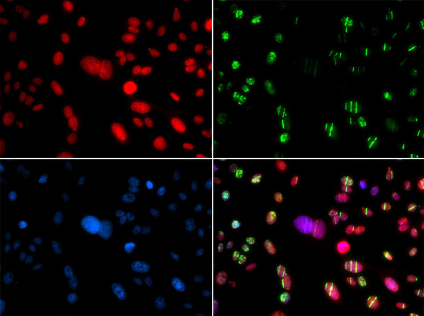 KO Validated Antibodies 1 Anti-RAG2 Antibody CAB5626KO Validated