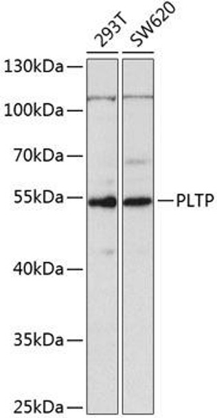 Cell Biology Antibodies 9 Anti-PLTP Antibody CAB5628