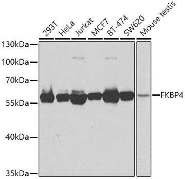 Cell Biology Antibodies 9 Anti-FKBP4 Antibody CAB5643