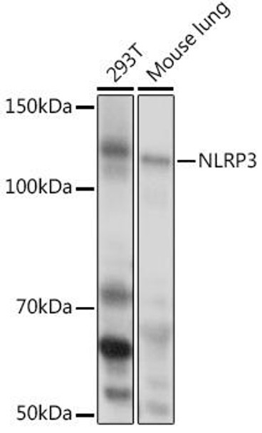 Immunology Antibodies 2 Anti-NLRP3 Antibody CAB5652