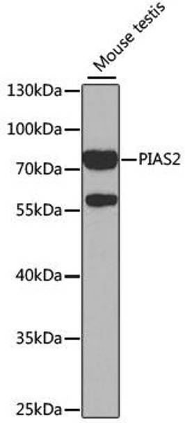 Epigenetics and Nuclear Signaling Antibodies 2 Anti-PIAS2 Antibody CAB5654