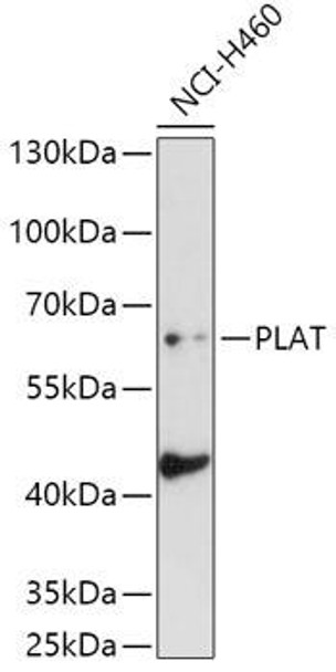 Cardiovascular Antibodies Anti-PLAT Antibody CAB5655