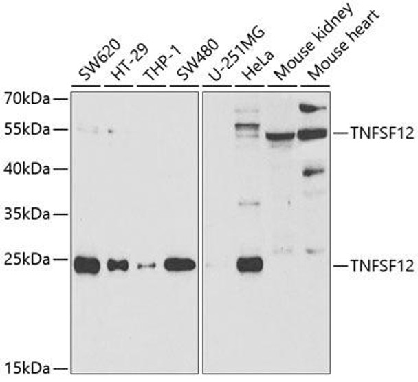 Cardiovascular Antibodies Anti-TNFSF12 Antibody CAB5659