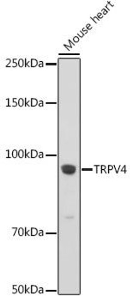 Cell Biology Antibodies 9 Anti-TRPV4 Antibody CAB5660