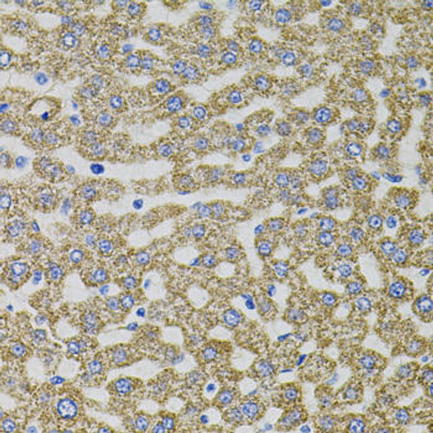 Immunology Antibodies 2 Anti-EPO Antibody CAB5663