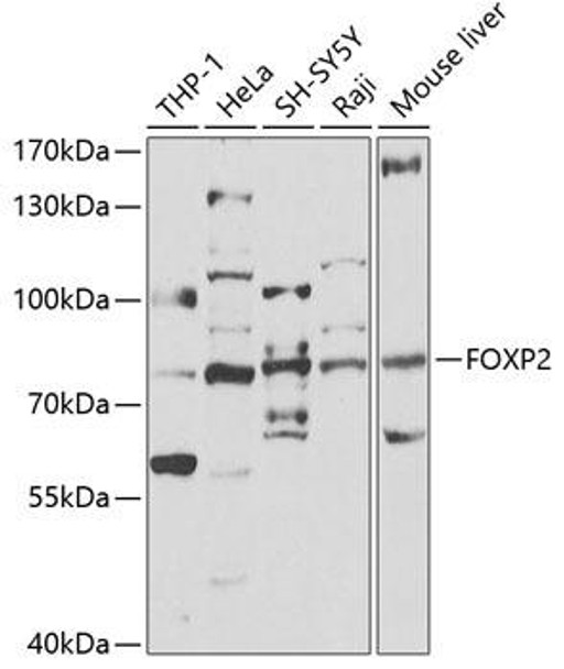Epigenetics and Nuclear Signaling Antibodies 2 Anti-FOXP2 Antibody CAB5677